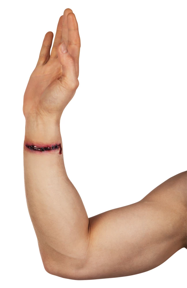 Nep Wond Gehecht Applicatie 3 Nep Wond Gehecht Applicatie