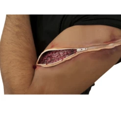 Nep Wond Zip It Applicatie