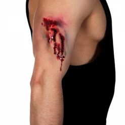 Nep Wond Gebeten Applicatie